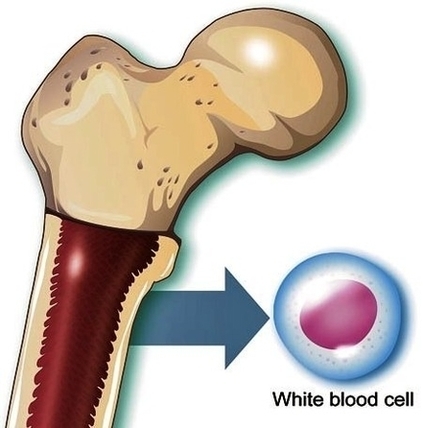 What Causes Blood Cancer Image