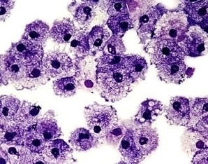 White Blood Cells Image