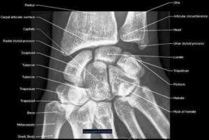 Wrist Radiography Ap View Imaios Anatomy En Medical Image - Graph Diagram