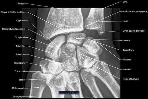 Wrist Radiography Ap View Imaios Anatomy En Medical Image