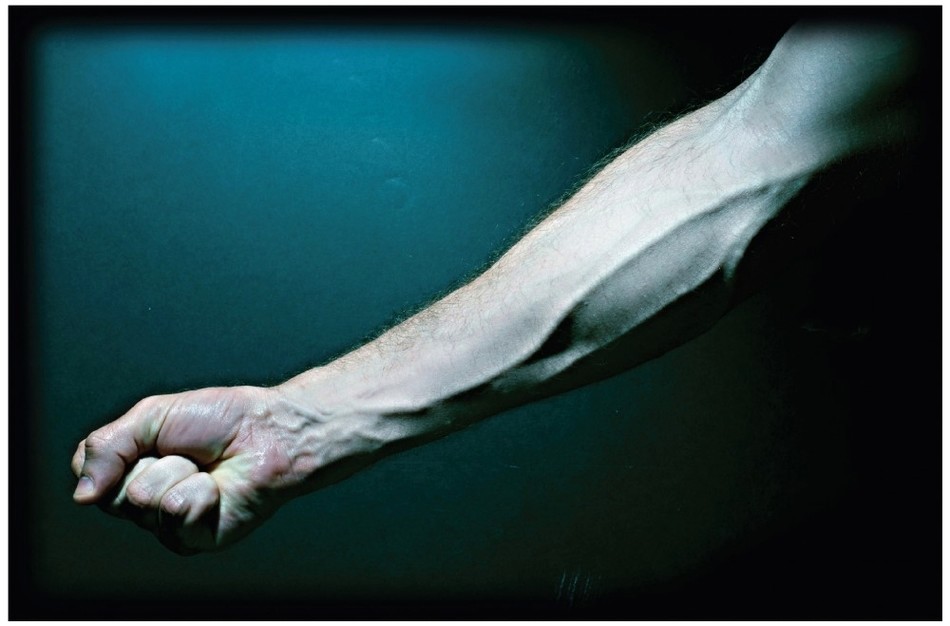Arm with Bulging Veins