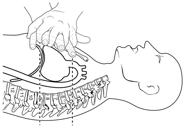 CPR Technique