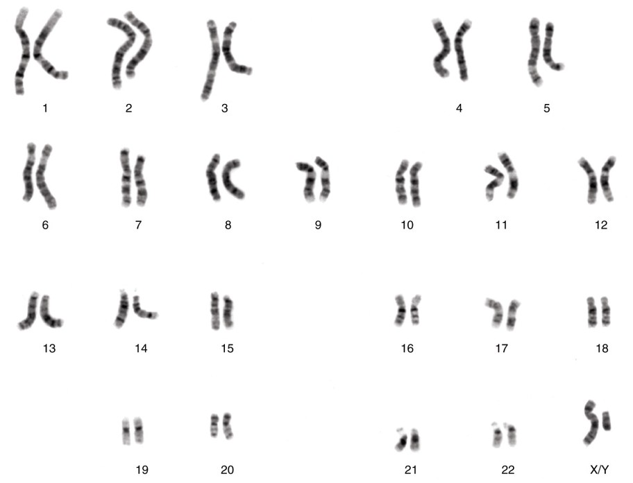 Male Chromosomes