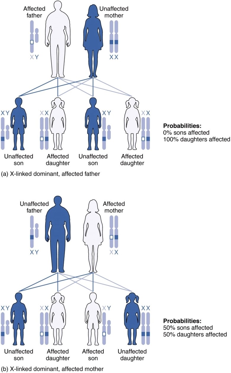 X linked Dominant Inheritance new