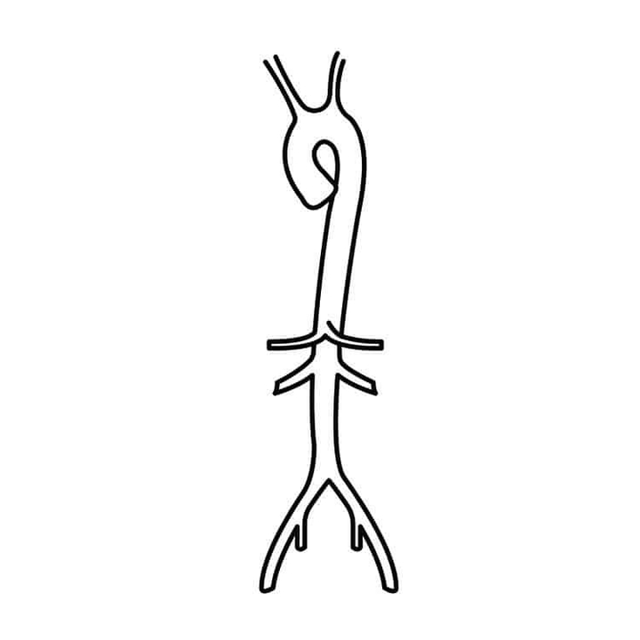 Aorta