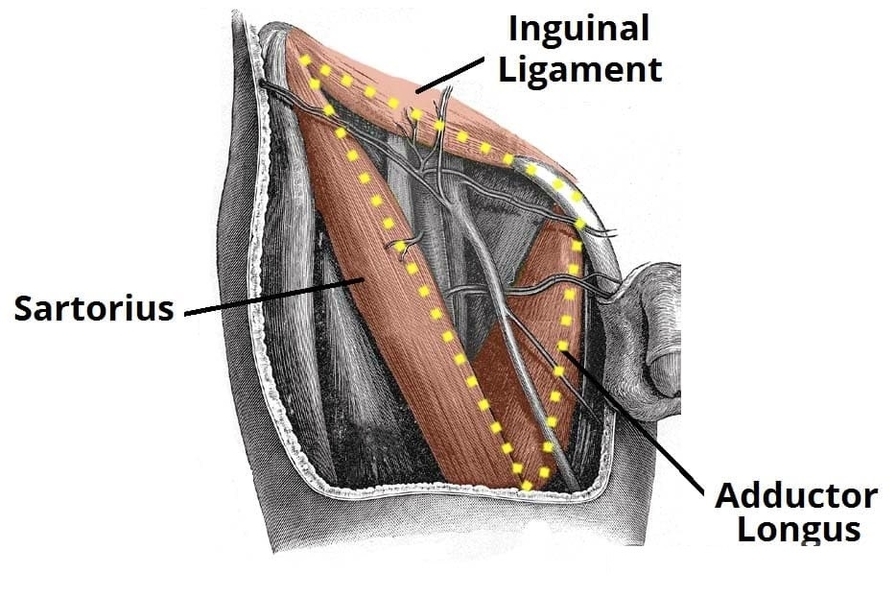 Borders of the Femoral Triangle