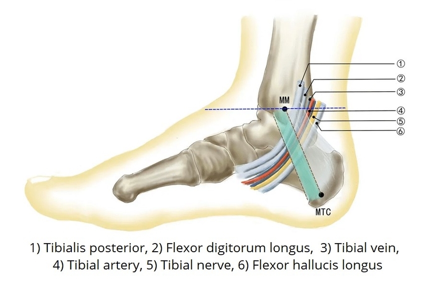 Contents of the Tarsal Tunnel