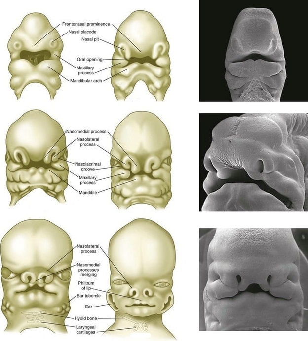 Development of the Nose and Face
