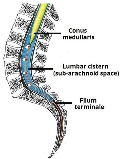 Distal End of the Spinal Cord The Lumbar Cistern