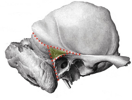 Mastoid Fossa Overview