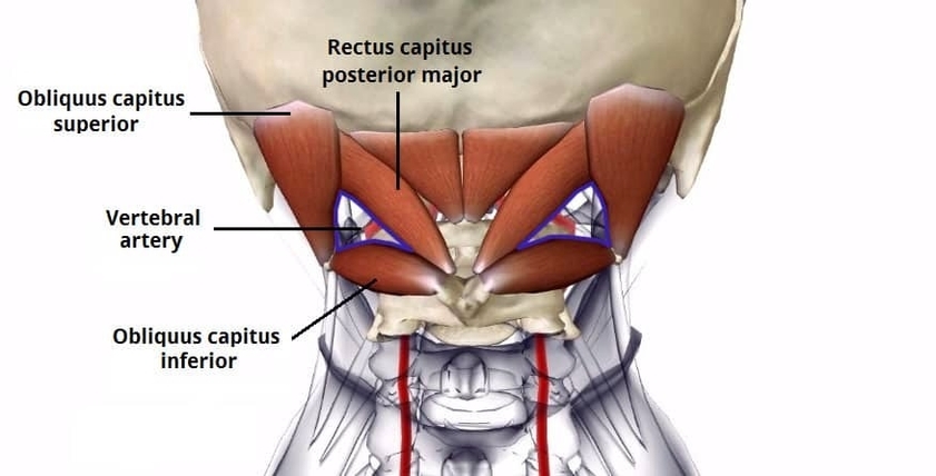 Suboccipital Triangle Borders and Vertebral Artery