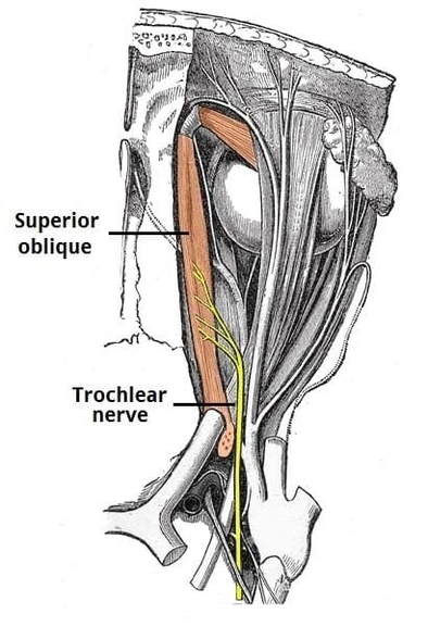 Trochlear Nerve and Superior Oblique